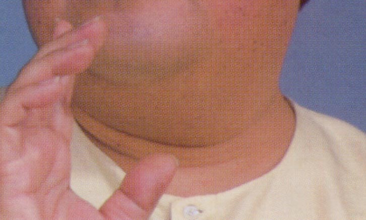 augjowls