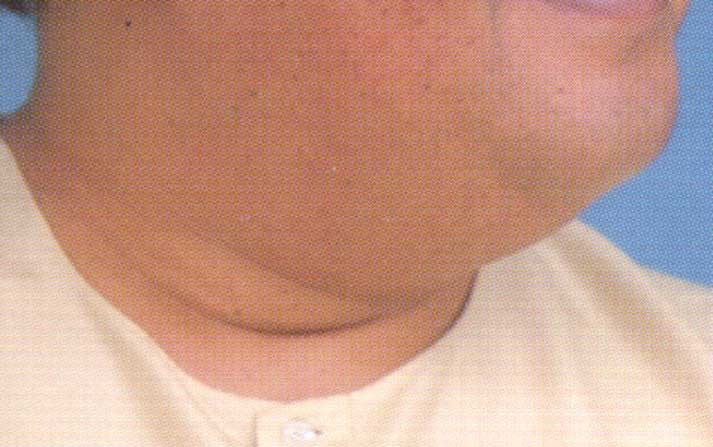 octjowls